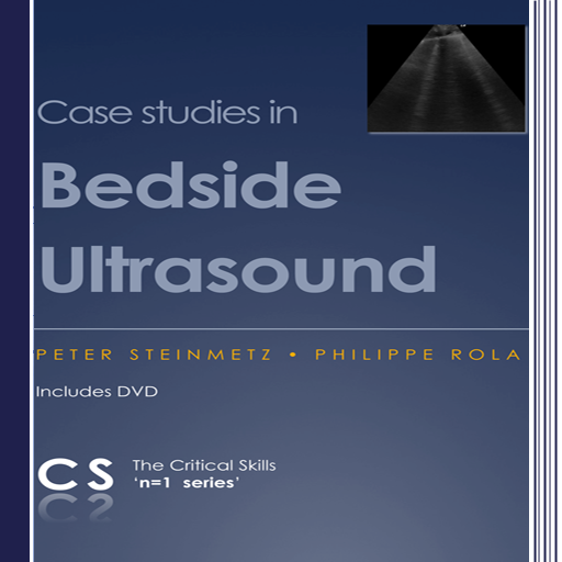 50 CASES OF BEDSIDE ULTRASOUND