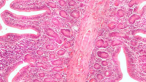 Resultado de imagen de intestino delgado al microscopio optico