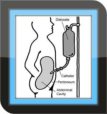 Kidney Disease - Guide