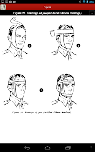 Bandaging and Splinting Screenshots 21