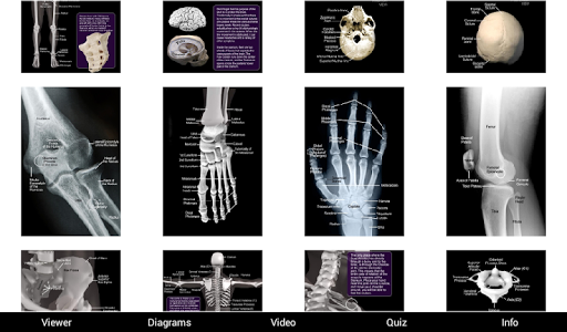 【免費醫療App】Skeletal Anatomy 3D-APP點子