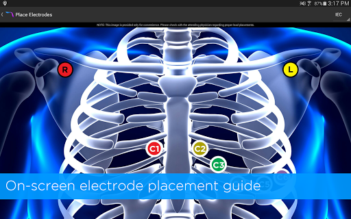 Alirus ECG