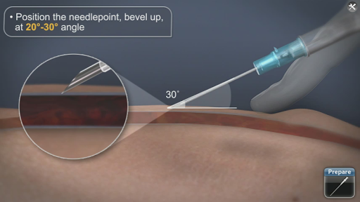 免費下載醫療APP|Medrills: Obtaining IV Access app開箱文|APP開箱王