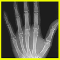 Xray icon