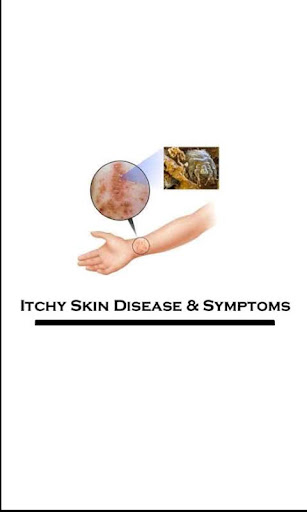 Itchy Skin Disease Symptoms