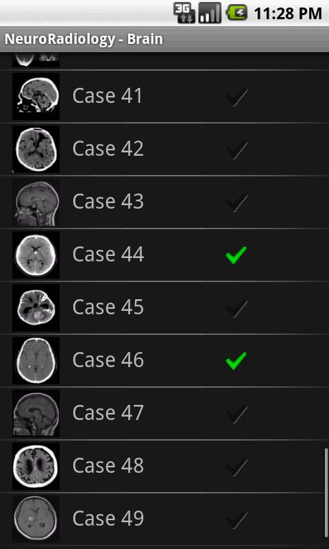 NeuroRadiology - Brain Screen 2