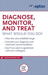 optomap® UWF™ retinal imaging Screenshots 2