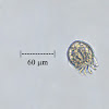 Protozoan - Uronychia