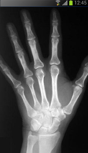 X-ray Scanner Prank