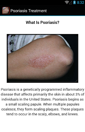 【免費醫療App】Psoriasis Treatment-APP點子