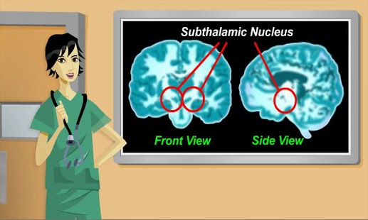 Virtual Surgery :Brain Surgery