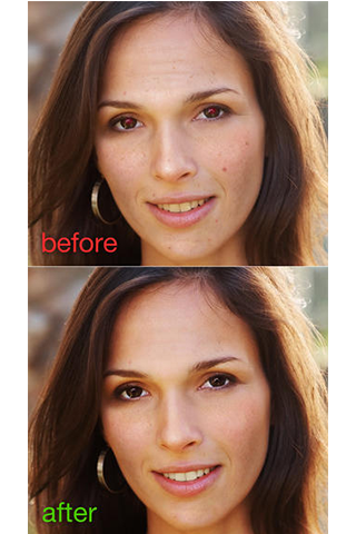 Blemish Remover Free