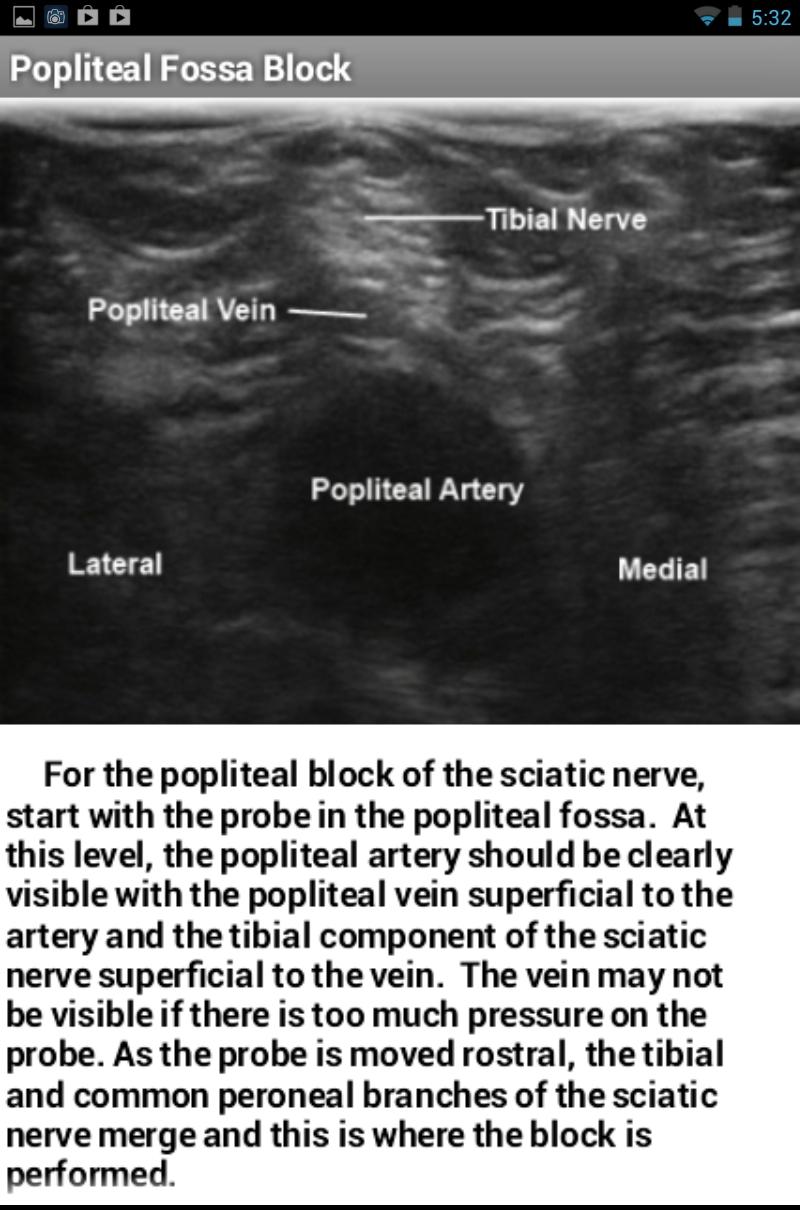 Ultrasound Regional Anesthesia Screen 2