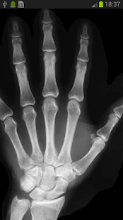 X-Ray Scanner - screenshot thumbnail