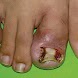Skin Disorders