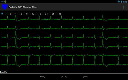 Bedside ECG Monitor Elite