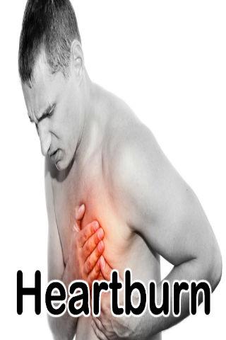 Heartburn Treatment