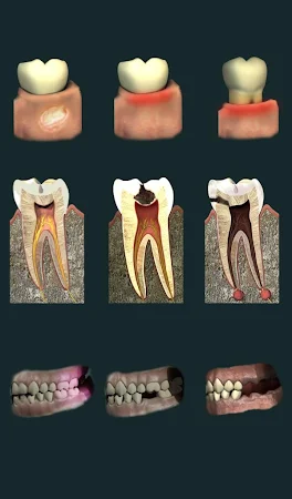 Dental Pain v1.01