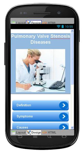 Pulmonary Valve Stenosis