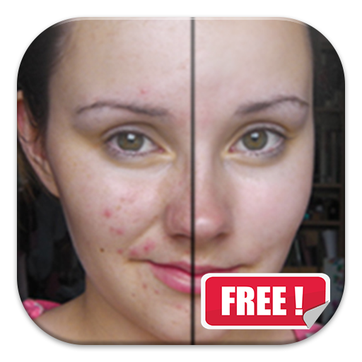 免費下載攝影APP|Blemish Remover Free app開箱文|APP開箱王