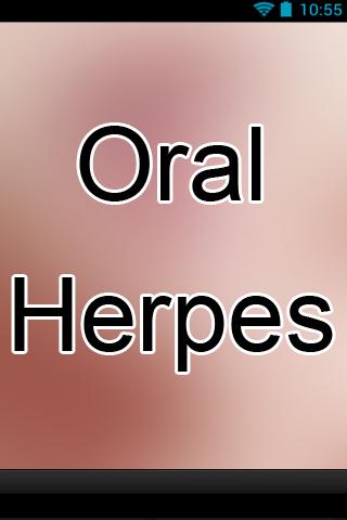 Oral Herpes