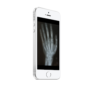 How to mod Xray Scanner lastet apk for android