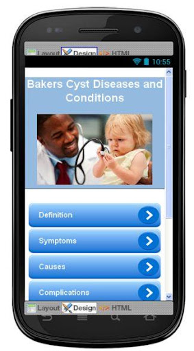 Bakers Cyst Disease Symptoms