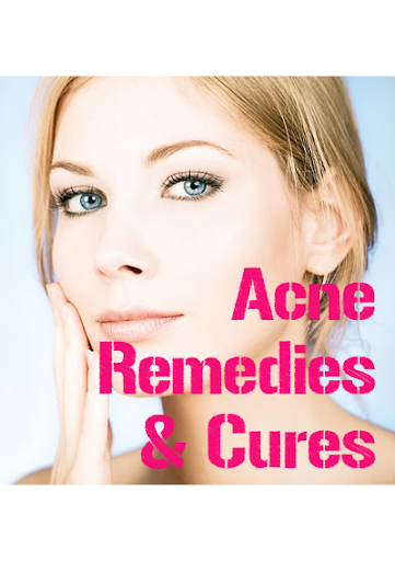Acne Remedies and Cures