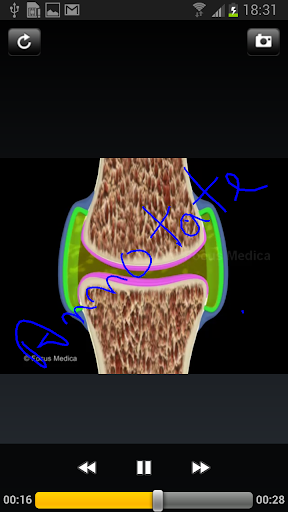 【免費醫療App】Atlas of Rheumatoid Arthritis-APP點子