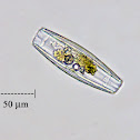 Diatom (Side view)