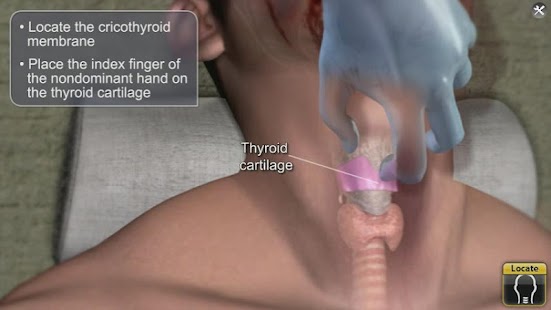 How to download Medrills: Army Crico 1.50e unlimited apk for android