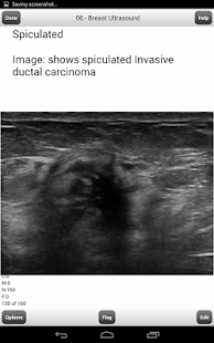 How to mod ARDMS BREAST ULTRASOUND LITE 2.46 unlimited apk for laptop