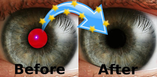 Red Eye Removal -  apk apps