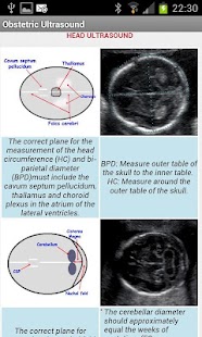 Obstetric Ultrasound-Lite Screenshots 3