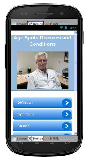 Age Spots Disease Symptoms