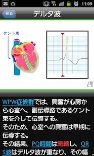 らくらく心電図トレーニング（英語モード付き） Screen 3