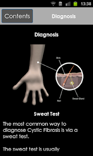Free Cystic Fibrosis:A Pocket Guide APK