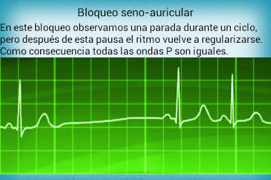 Electrocardiograma PRO poster 3