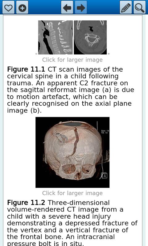 ABC of Imaging in Trauma Screen 3