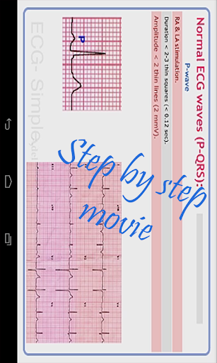 【免費醫療App】ECG Simple-APP點子