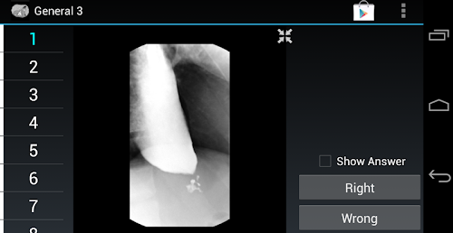 Android application Radiology Flashcards: General3 screenshort