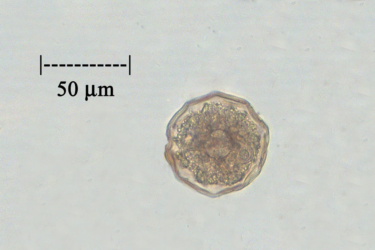 Heliozoan (Cyst)