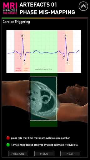 【免費醫療App】MRI Artefacts 01-APP點子