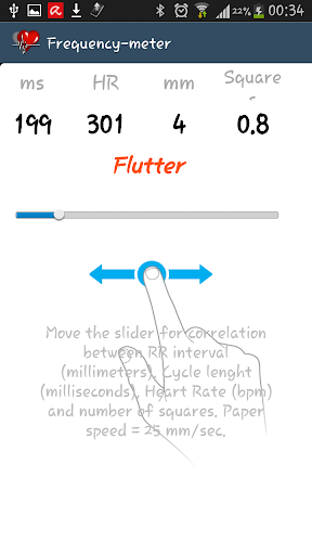 【免費醫療App】ECG practical-APP點子