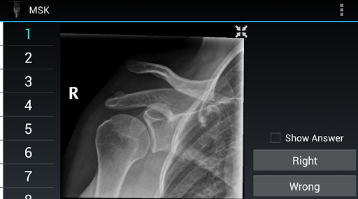 Radiology Flashcards: MSK