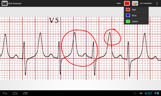 How to mod ECG Analyzer 1.5 unlimited apk for pc