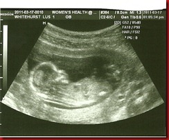 Baby 1 @ 13 weeks (profile shot)