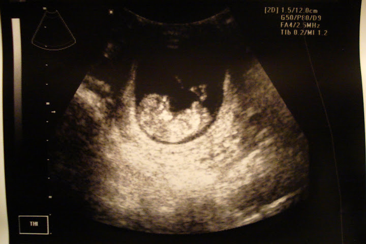 NDbabybean!
