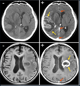 CT dan MRI kontras