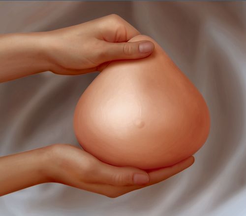 عملية بناء الثدي بعد إستئصاله زرع الثدي تجميل الصدر بناء الثدي اعادة تكوين الثدي منتدى النرجس
